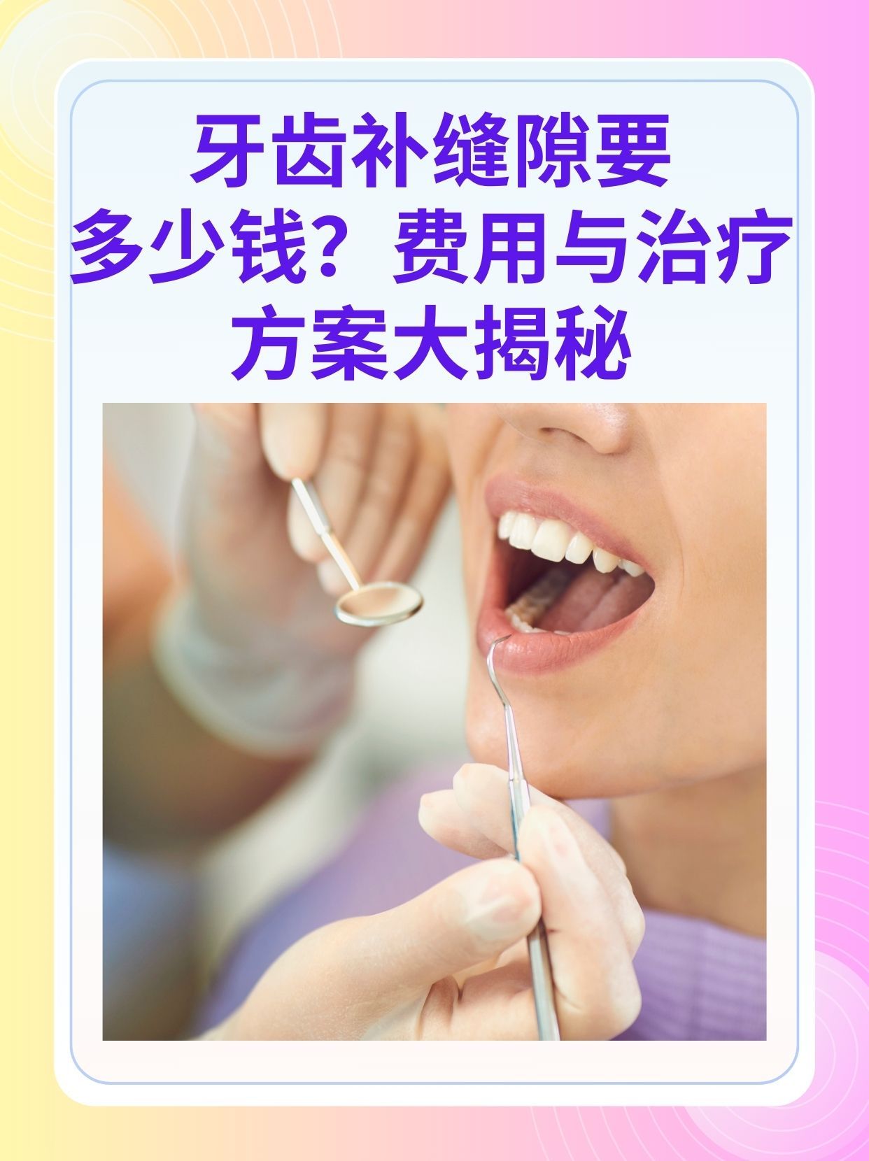 内江补牙医保可以报销吗(补牙医保可以报销吗 哪些可以报销呢)